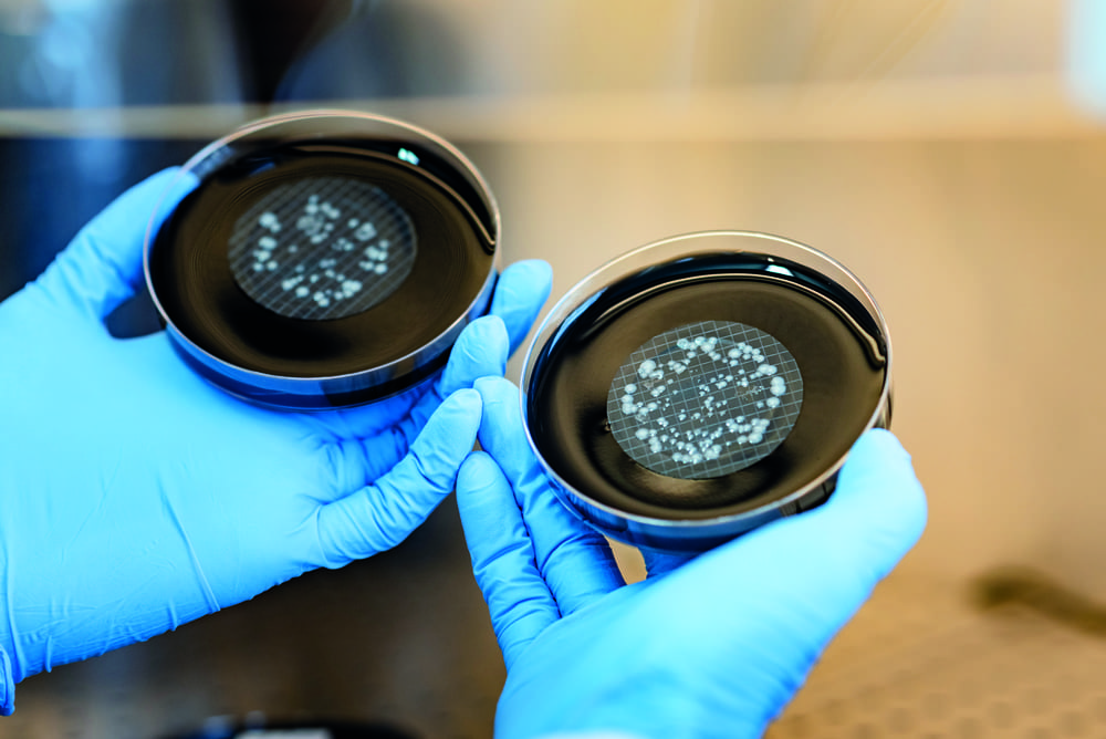 Legionella nei condomini
